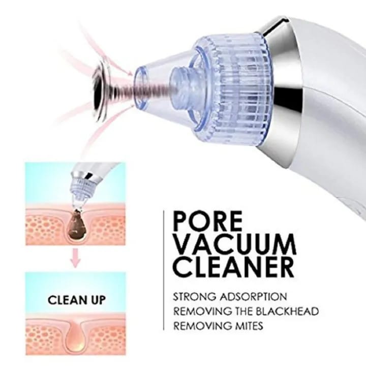 Blackhead Acne Oil Remover Vacuum Suction Face Pore Cleaner Facial Beauty Equipment, Blackhead Removal Machine