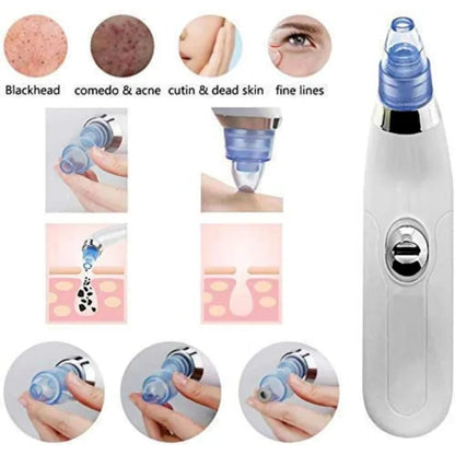 Blackhead Acne Oil Remover Vacuum Suction Face Pore Cleaner Facial Beauty Equipment, Blackhead Removal Machine