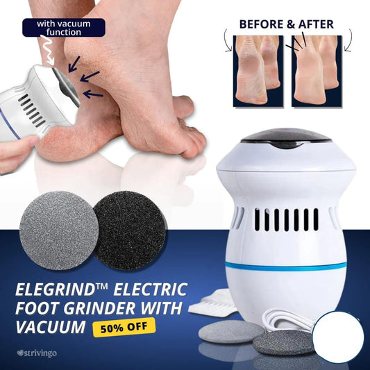 Electric Foot Grinder with Vacuum – Pedicure Callus Remover & Dead Skin Cleaner